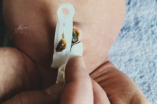 Cuidados com o cordão umbilical: saiba como cuidar do seu recém nascido - Mustela Brazil - 1