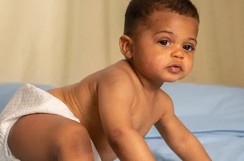 Cuidados com a dermatite atópica - Mustela Brasil - 1