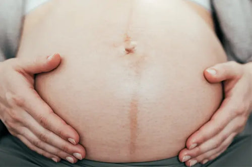 Barriga de mulher grávida com mancha linear de cima pra baixo. - Mustela Brasil - 1