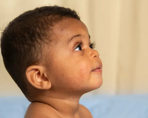 Bebê olhando para o horizonte com olhar tranquilo e a pele com pequenas manchinhas avermelhadas. - Mustela Brasil - 1