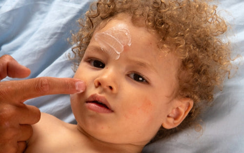 Uma mão adulta passando creme hidratante em uma criança de cabelos claros cacheados que está deitada em uma cama. - Mustela Brasil - 1