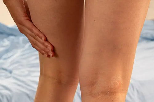 anti-itching-collection - Mustela Brasil - 1